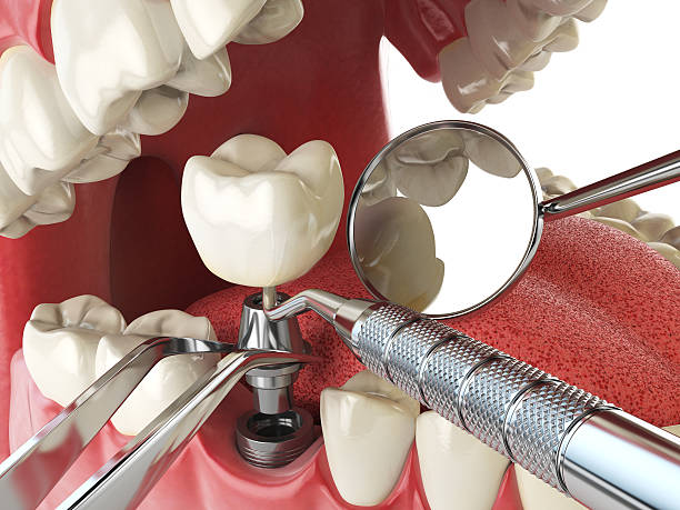 Best Emergency Denture Repair in Pittston, PA